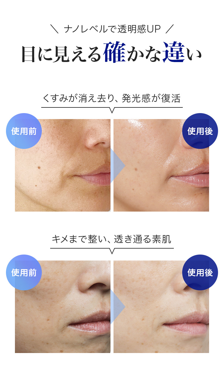 ナノレベルで透明感UP 目に見える確かな違い