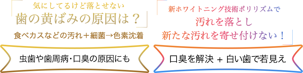 気にしてるけど落とせない歯の黄ばみの原因は？食べカスなどの汚れ＋細菌→色素沈着