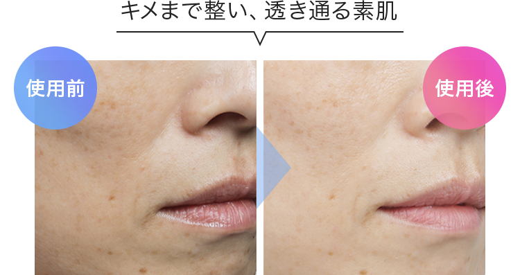 キメまで整い、透き通る素肌